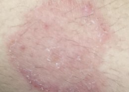 السلام عليكم ، احد من قبل صاده هالفطريات ، صار …