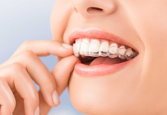 Invisalign Specialist In Bahrain